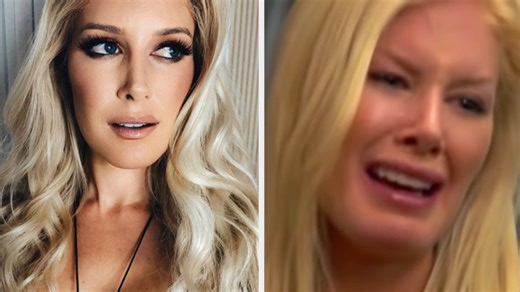 4.8K views · 36 reactions | Jaw-Dropping Botched Celebrity Surgeries You Have to See #plasticsurgery #celebrities | Inform Overload | Facebook