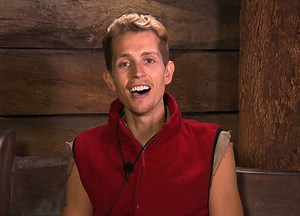 The Vamps' Fears For James McVey In The Jungle Over His Past