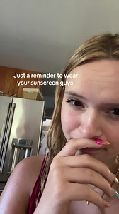 #sunburn #sunpoisoning #fyp #bye | sun poisoning