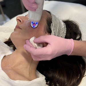 Laser Skin Treatments | Quinn Clinics, Bristol