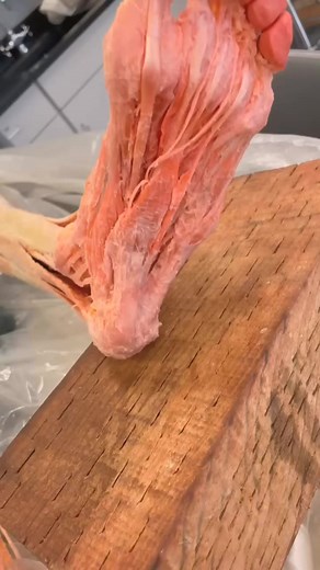 Real Human Foot Muscles!#humen #body #fitness #fit #abs #healthy #gymlife #life #Doctor #reels #shorts | Human Anatomy