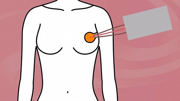 Effective breast cancer treatment less common in US