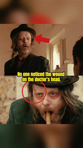 No one noticed the wound on the doctor’s head.#fyp #tiktok #movie #fallout #fallout2