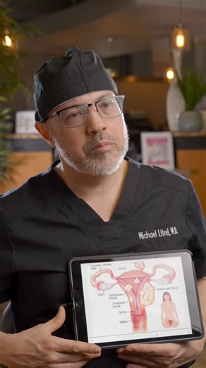 what is a fibroid tumor, and what are the symptoms? I'll explain. #obgyn #period #Healthcare #womenhealth #women #period #fypシ | Mike Litrel, MD