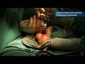Titan OTR Peno Scrotal Surgical Procedure - Part 5