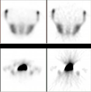 Iterative reconstruction - Alchetron, the free social encyclopedia