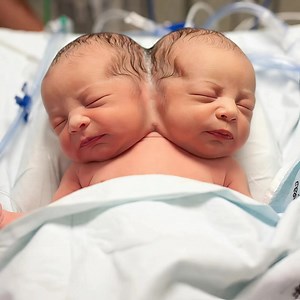 Lægerne advarede hendes forældre om at forberede sig på det værste. De var ikke sikre på, at den lille pige ville overleve selv den første dag, og luften på fødestuen virkede frossen, stille bortset fra maskinernes lyde. Men det, som ingen kunne forudsige, skete.⚠️💪 Maryam overlevede ikke kun, men hun forvandlede også det, folk troede var muligt. Hendes billeder spredte sig på sociale medier, og verden begyndte at spørge, hvordan hun overvandt det, som selv medicinen havde tvivlet på.🚫 Hendes