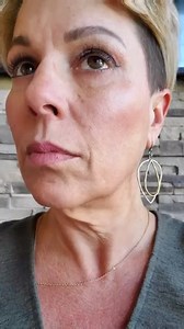 ✨ Transformación Increíble ✨ ¡Descubre el antes y después de una #Ritidectomía que redefine la juventud! 🌟 Este procedimiento, conocido como lifting facial, es la clave para un rostro rejuvenecido y radiante. 💆‍♀️ Mira cómo los signos del envejecimiento desaparecen para dar paso a una piel firme y fresca. ¡Es hora de que brilles con confianza! 💫 #LiftingFacial #BeforeAndAfter #CirugíaPlástica #Rejuvenecimiento #Estética #Belleza #GlowUp #Transformación #PlasticSurgery #BookNow #Plasticsurgery