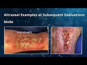 Altrazeal Application Video