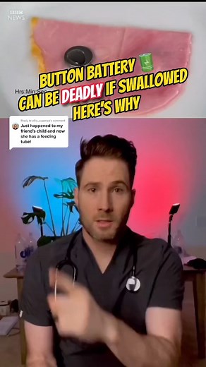 wallowed button battery can be deadly and burn your esophagus. #doctor #constipation #fiber #nutrition #medical #growthmindset #ambulance #emergency #healthcare #doctorreact #residency #Psychologist #skincare #healthy #medicine #cancer #chiropractic #pimplepopper | Doctor Joe