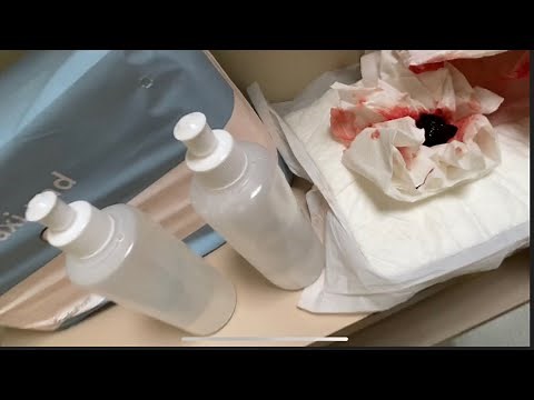 REAL RAW UNCUT CHILD BIRTH AFTER MATH *VERY GRAPHIC*