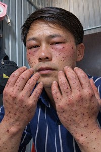 3.3M views · 44K reactions | Chưa tới tổ ong mà đã bị tấn công rồi năm nay buồn thật #ongrung #rung #matong @nêu bật | Vàng Seo Chớ | Facebook