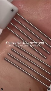 "The industry’s leading in Microcurrent technology and only with dynamic intelligence. Featuring a bio-feedback monitoring loop optimizing the results for each and every client!" Client Appreciation for @theskinstandard_ ! #microcurrent #NeurotriS #Facial #Persoanltoner #estehtician | Neurotris