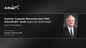 Superior Capsular Reconstruction With ArthroFLEX® Graft: Does the Graft Heal?
