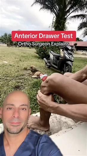 Impressive example of an anterior draw test of the knee. ACL is definitely gone, probably a lot more ligament damage as well based on how loose this knee is! 😷✅Follow David Abbasi, MD - Sports Medicine & Orthopedic Surgery for More Daily Medical Content & Health Tips! #acltear #acl #knee #medical #orthopedics #drabbasi | David Abbasi, MD - Sports Medicine & Orthopedic Surgery