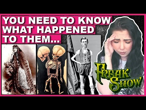 The SAD TRUTH About 'Freak Show' Performers