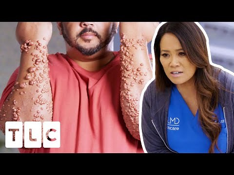 Dr Lee Has NEVER Seen A Case Of Cholesterol Bumps THIS Bad | Dr. Pimple Popper