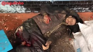 Ukraine Soldier Legs Got Torn Off