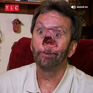 This man has a 2.5% chance of survival, but he beats all of the odds by sacrificing his nose... 🤯 #BodyBizarre | TLC UK