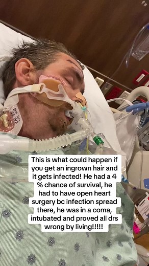 Surviving an Infected Ingrown Hair: A Miracle Story of Overcoming Coma