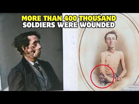 Heroes in Pain: Rare Photos of Wounded Civil War Soldiers