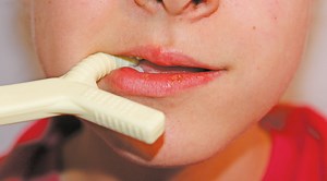 Les outils thérapeutiques de mastication