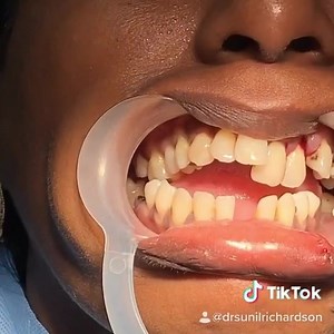 We take care of your face like no one else... Got any issues with your teeth, smile, jaws, nose, ears or hair? We will fix it back with ease and for life - just like this!! www.facesurgeon.in | Richardsons Dental & Craniofacial Hospital | Facebook