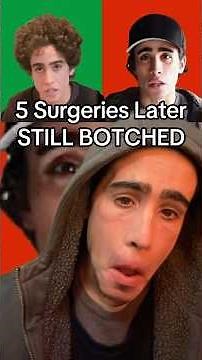 STILL BOTCHED after Orbital Reconstruction