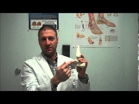 Accessory Navicular Syndrome