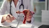 Gynecologist shows anatomical model of uterus and ovaries. Female...