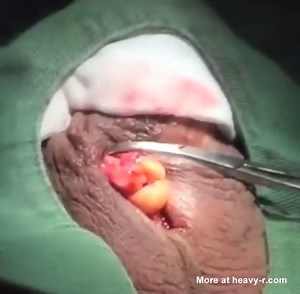 Scary Castration Video