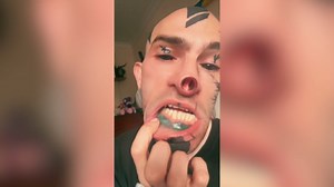 I removed my nose and nipples — now I'm harassed in the streets