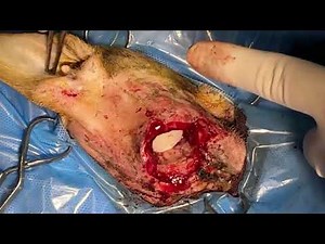 Enucleation of eye & surgical wound repair by transposition flap in cat.