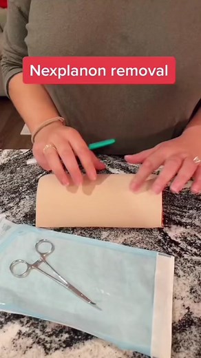 Nexplanon birth control implant removal! #womenshealth #obgyn #femininehygiene #BirthControl #BirthcontrolOptions #nexplanon #nexplanonremoval #nexplanonremoved