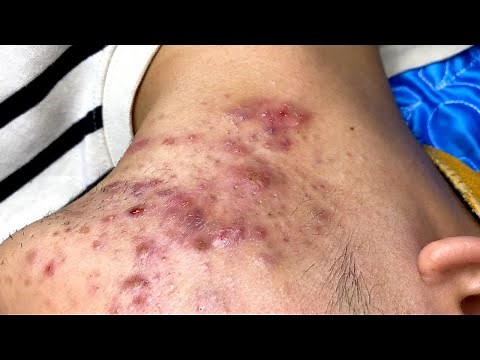 Relax Every Day With Sac Dep Spa #0292