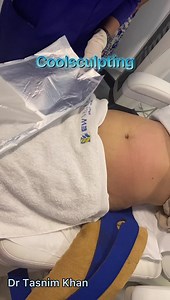 27K views · 391 reactions | Procedure: Coolsculpting Nonsurgical permanent fat removal procedure #bodycounting #bodyshaping #coolsculpting #AllerganAesthetics #drtasnimkhan | Dr Tasnim Khan | Facebook