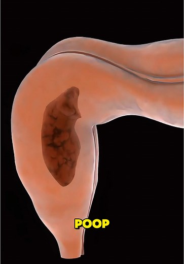 Understanding Digestion: How Food Becomes Poop