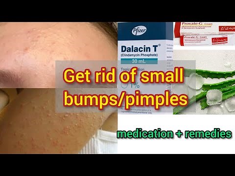 How to get rid of small bumps, pimples after waxing and threading