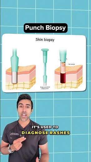 What a Punch Biopsy Really Looks Like