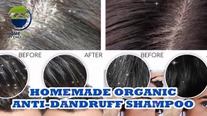 HOMEMADE ORGANIC ANTI-DANDRUFF SHAMPOO | Homemade Beauty Tip