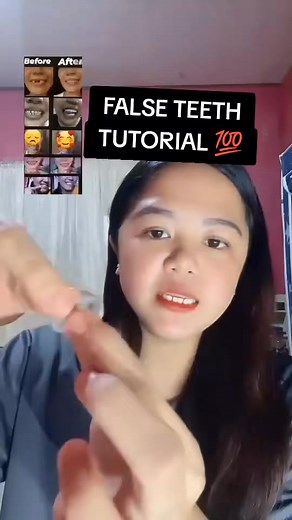 Temporary Tooth Repair Kit Filling Solid Gel 30ml Denture Adhesive FreeShipping | Munley Gregory Beckham