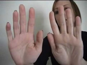 RSD/CRPS Symptoms- swelling, colour change, muscle spasms