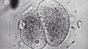 Test Tube Babies: Chapter 1 | American Experience | PBS