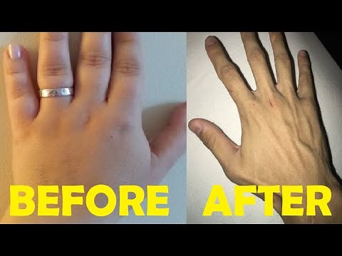 how to get rid of chubby hands