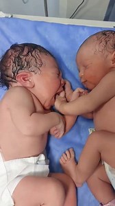 1.1M views · 84K reactions | #babyfirstminutes #cutebaby #love #twins look at this beautiful miracle  | Baby first minutes | Facebook