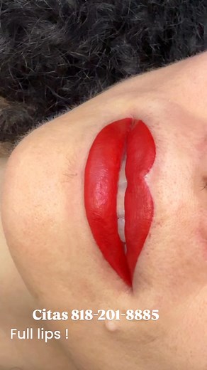 Full lips, Full Colors Relleno de Labios Dale forma, vida y color a tus labios con esta técnica Incluye: 🔜Asepsia preparar tu piel 🔝Anestesia de alto porcentaje para tu mayor comodidad 🔜Diseño 🔜Perfilado de labios para darle forma dependiendo de tu contorno natural y del grosor de tus labios 👄 🔝Anestesia Secundaria prevenir Dolor 🔜 técnica de Relleno 🔜Cuidados Posteriores 🔛El procedimiento tarda alrededor de 3 Hrs El full Lips dura entre 2 y 3 años dependiendo del cuidado posterior y el