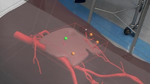 62 reactions | HoloLens allows the surgeon to superimpose computed...