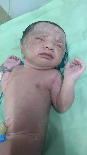 Medical Education video: Neonatology: Grunting respiration in a newborn