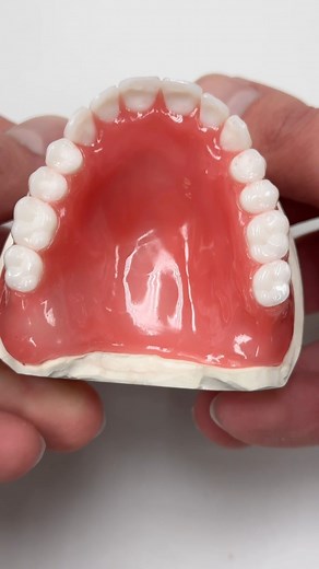 Upper Wax Try-In! Case from Dr. Steven Mee in Illinois! | CEO Luke Kahng