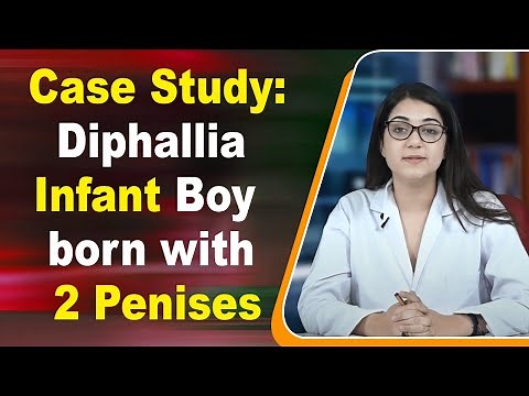 Case Study: Diphallia Infant Boy born with 2 Penises